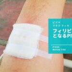 Pigsa（ピグサ）って何？フィリピンでかかる細菌性皮膚感染症の原因や症状を説明するよ