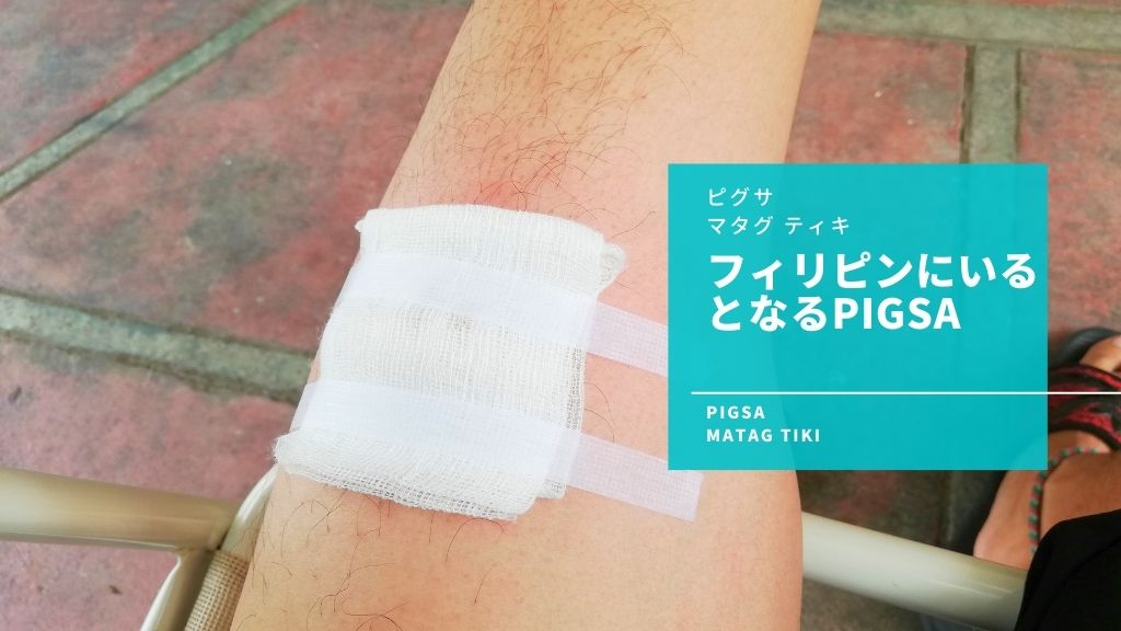 Pigsa（ピグサ）って何？フィリピンでかかる細菌性皮膚感染症の原因や症状を説明するよ