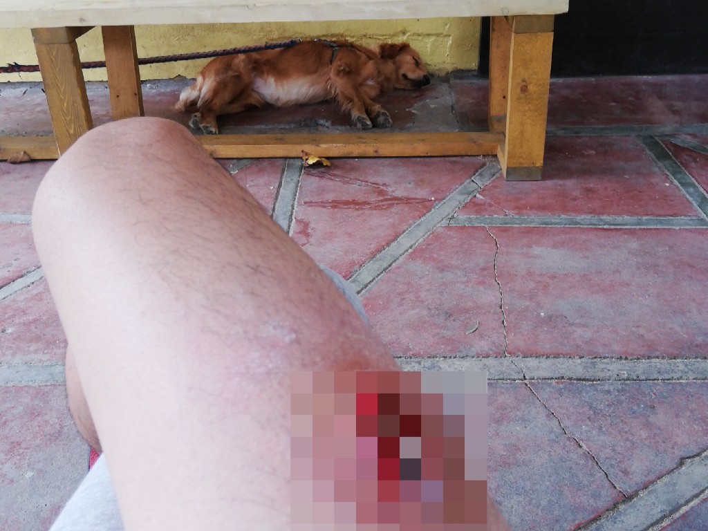 まとめ 細菌性皮膚感染症のPigsa(ピグサ)は地獄の痛みなので覚悟してください